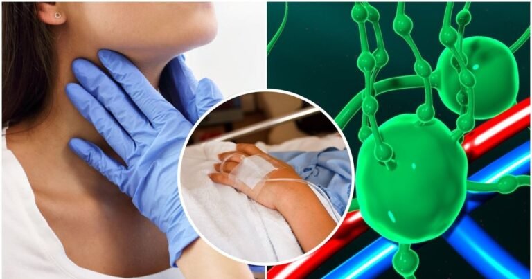 Padidėję limfmazgiai ne visada reiškia infekciją: gydytoja įvardijo, kada delsti pavojinga