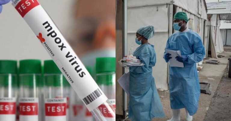 Maskvos srityje sunerimta dėl galimo viruso protrūkio: ligoninėje atsidūrė penki žmonės